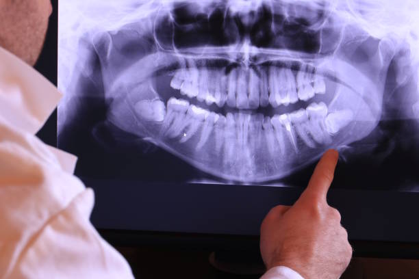Best Emergency Dental Care for Broken or Chipped Teeth in Proctor, MN